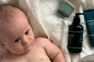  Baby with Cradle cap and Eczema on his back while his Mum applies Manuka Biotic Eczema Relief Body Lotion