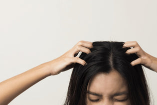  Lady scratching her head with both hands suffering Itchy Scalp