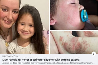  Mother with child in Daily Mail story on the miracle manuka for daughter's Eczema Relief. 
